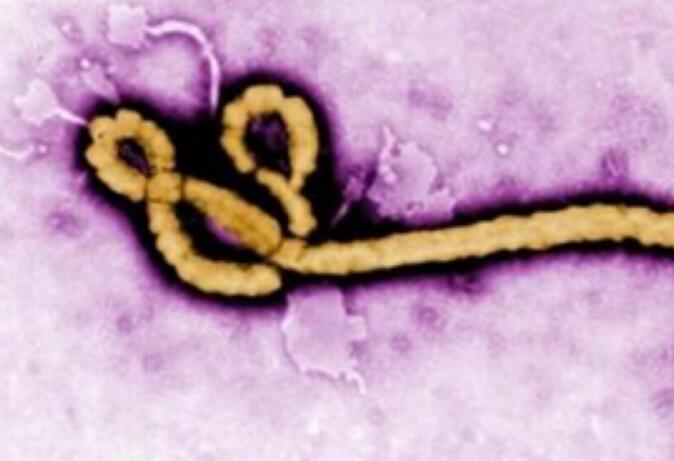 埃博拉病毒傳播途徑,攝入大量鹽水可防埃博拉是謠言